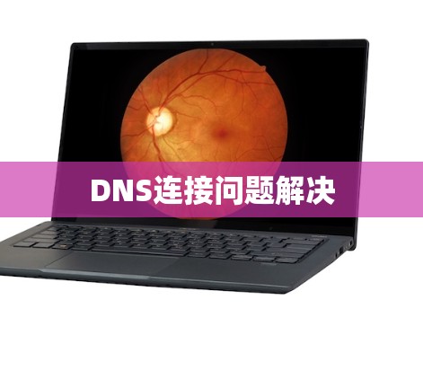DNS连接问题解决